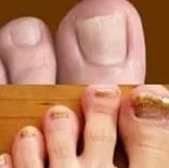 Gestart Form vum Pilzes